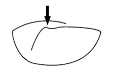 Pillow inserts installation method (2)